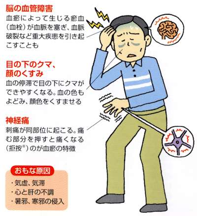 血オ